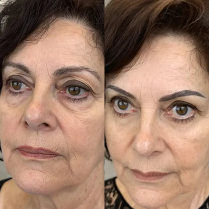 RevitalEyes® 2-in-1 Red Light Therapy + EMS To Erase Eye Bags